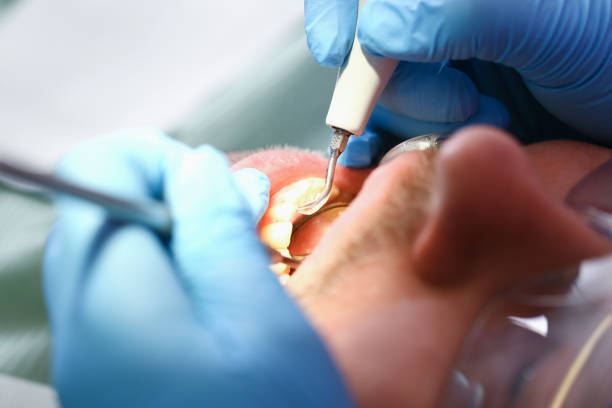 Best Emergency Dental Care for Broken or Chipped Teeth in Windham, OH