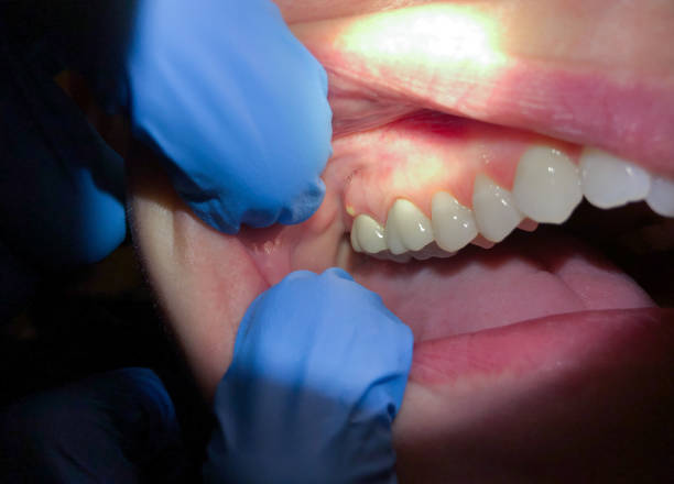 Best Emergency TMJ Treatment in Windham, OH